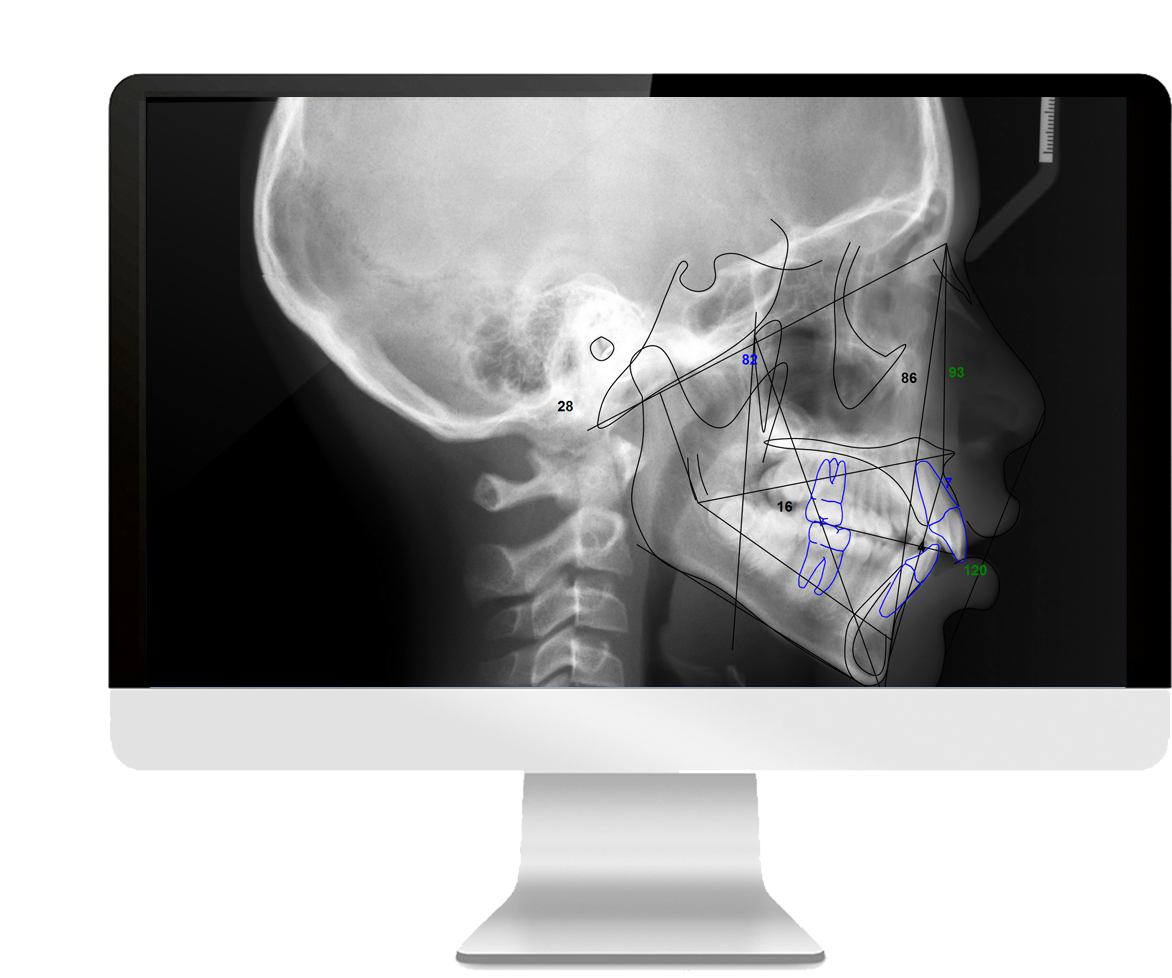 CBCT Interpretation