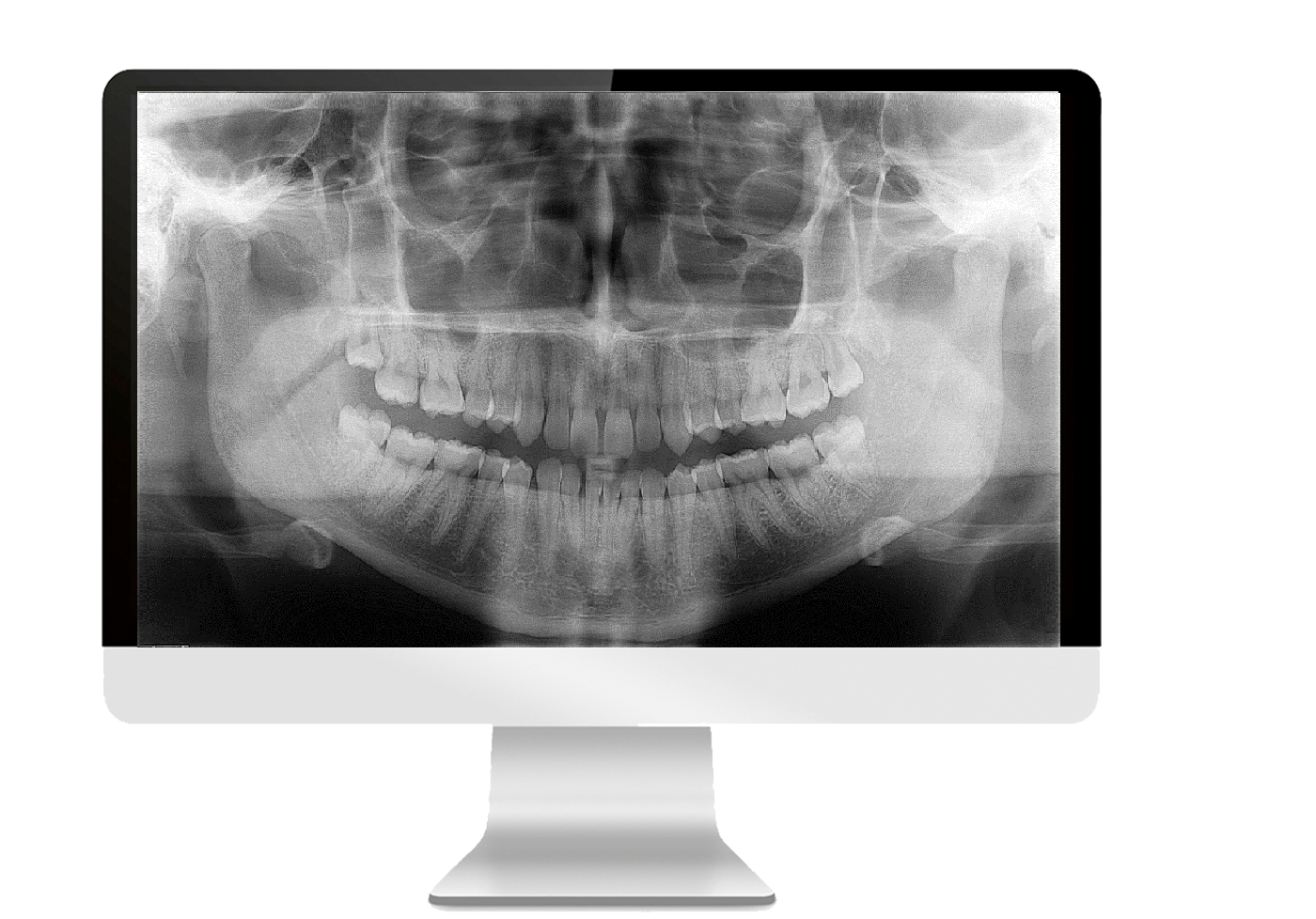 2-D Extraoral Digital Radiography