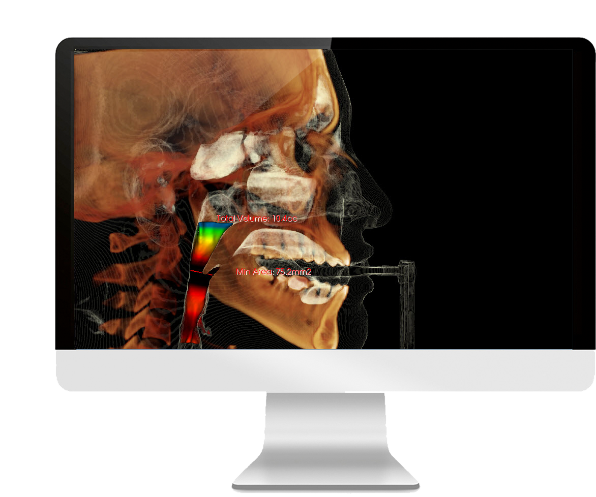 CBCT Interpretation