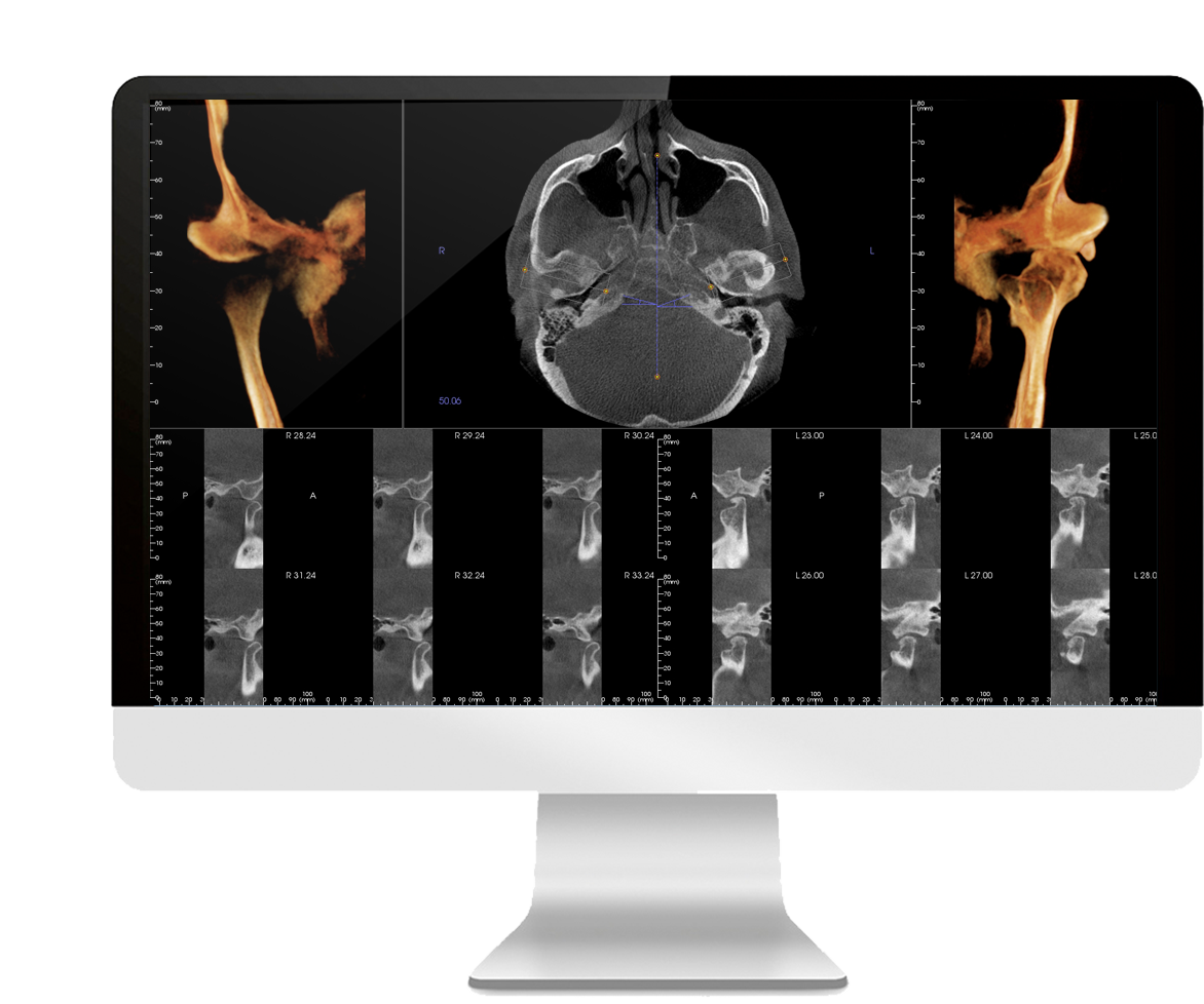 CBCT Interpretation